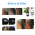 Hair Restoration SET 100% Natural Hair Restoration Spray + Tea | [한국산] 발모세트 (발모차, 발모팩)