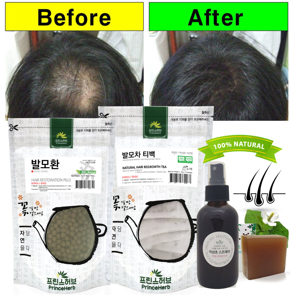 Hair Restoration Complete SET  Spray + Tea + Pills + Soap | [한국산] 발모4종세트 (발모차, 발모팩, 발모환, 어성초비누)
